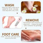 Râpe à Pieds Électrique Rechargeable (Kit Pédicure) – Image 5